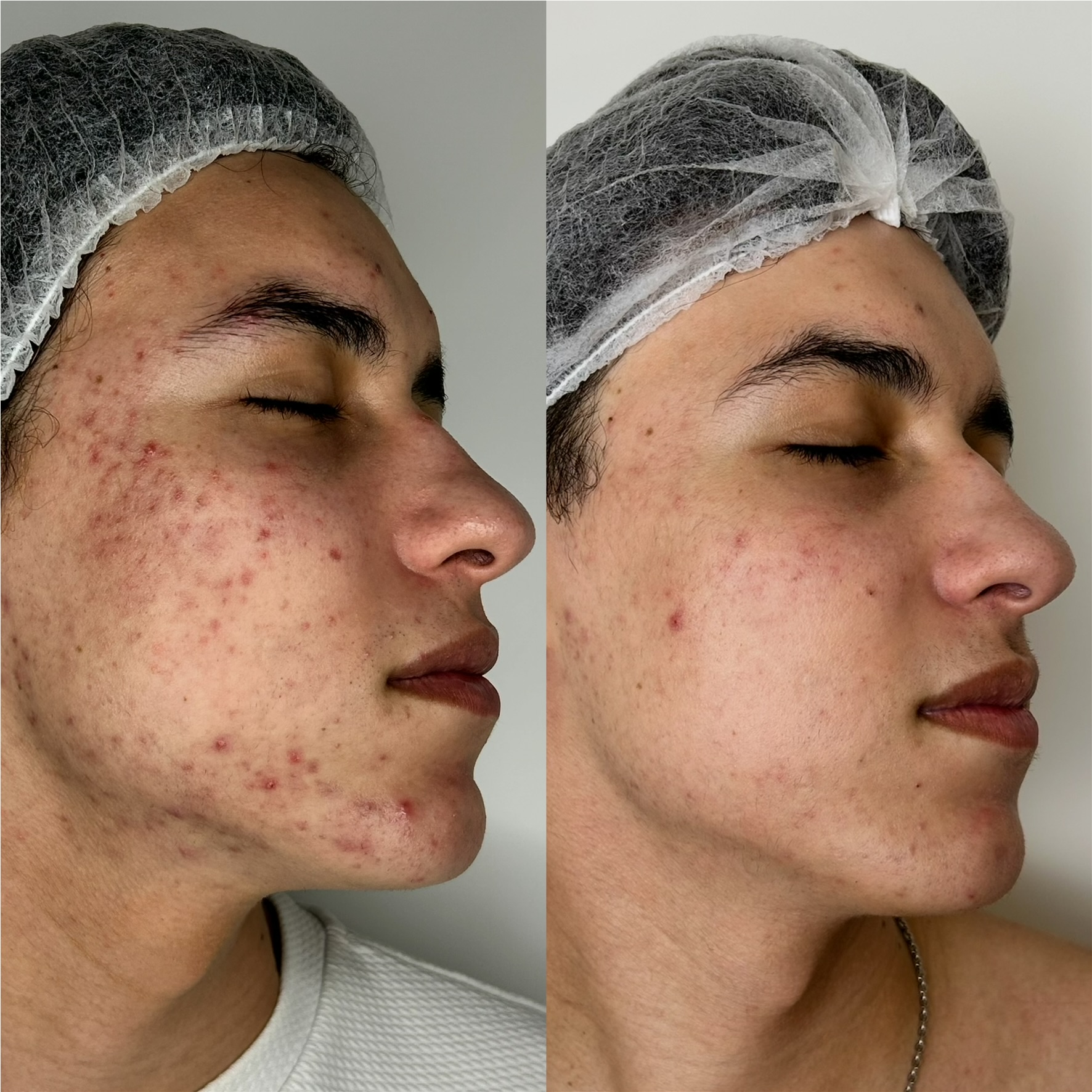Peeling Herbal - BIOAGE