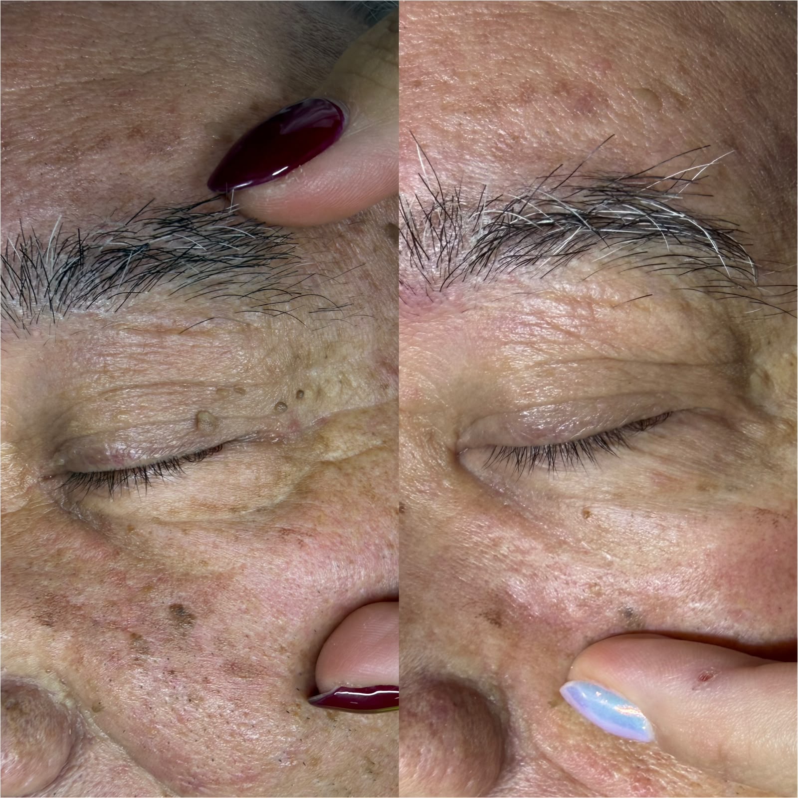 Jato de Plasma